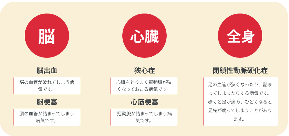 脳・心臓・全身
