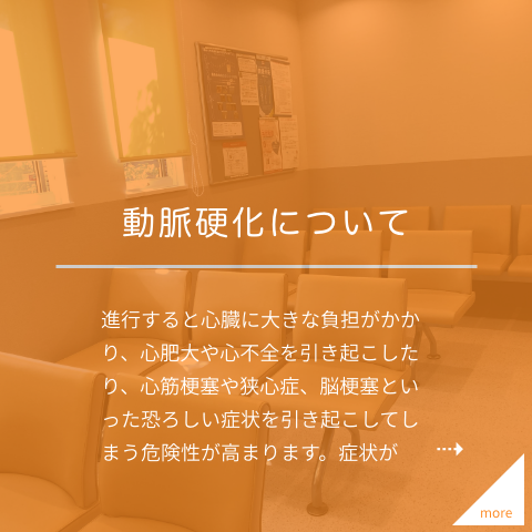 動脈硬化について