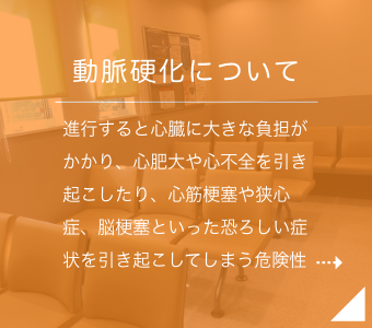 動脈硬化について